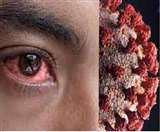 करगैना निवासी राजपाल सिंह को कोरोना के बाद हो गया था ब्लैक फंगस, एसआरएमएस में थे भर्ती।