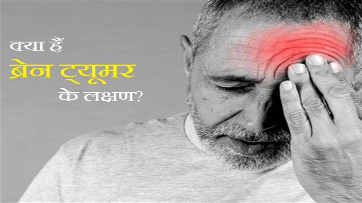 वर्ल्ड ब्रेन ट्यूमर डे 8 जून, गंभीरता से लें बे्रन ट्यूमर की समस्या को