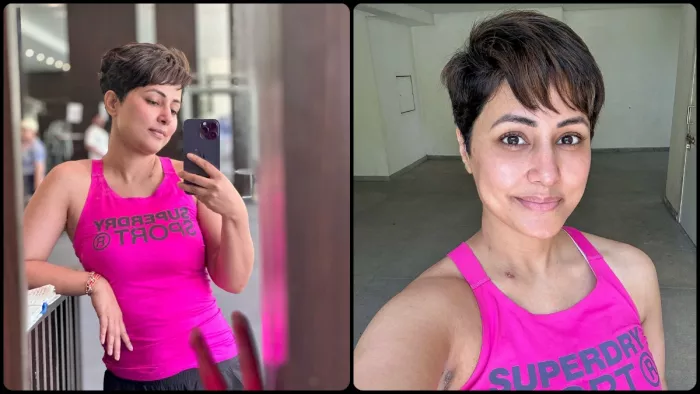 कीमोथेरेपी के बाद हिना खान के शरीर पर पड़े थे निशान। फोटो क्रेडिट- इंस्टाग्राम