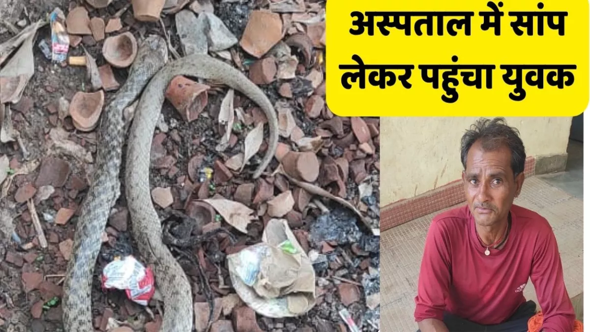 बोरी में सांप भरकर युवक पहुंच गया अस्पताल, डाक्टर हैरान, बोला-इसी ने डसा