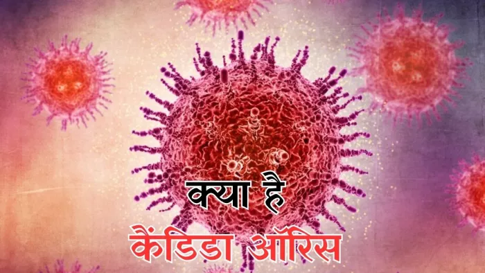 14 साल बाद फिर बढ़ रहे इस बीमारी के मामले (सांकेतिक फोटो)