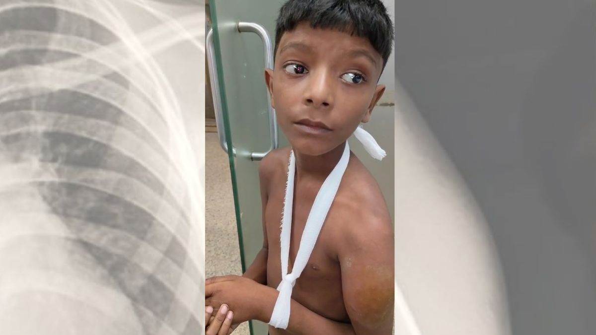ncr noida teacher beats student class 3 boy fractured for making noise