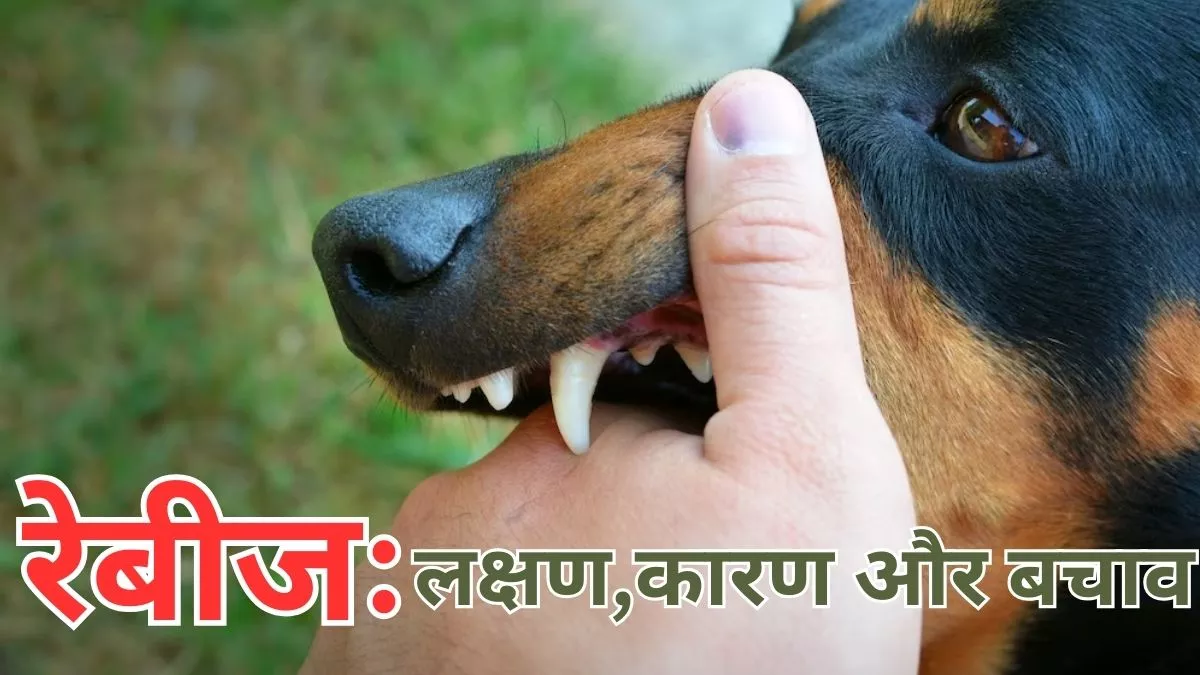 Rabies: गाजियाबाद में रेबीज ने छीनी 14 साल के बच्चे की जान, जानें इस गंभीर बीमारी के बारे में सबकुछ