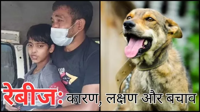 रेबीज की वजह से गई 14 साल के बच्चे की जान, जानें इस बीमारी के बारे में सबकुछ