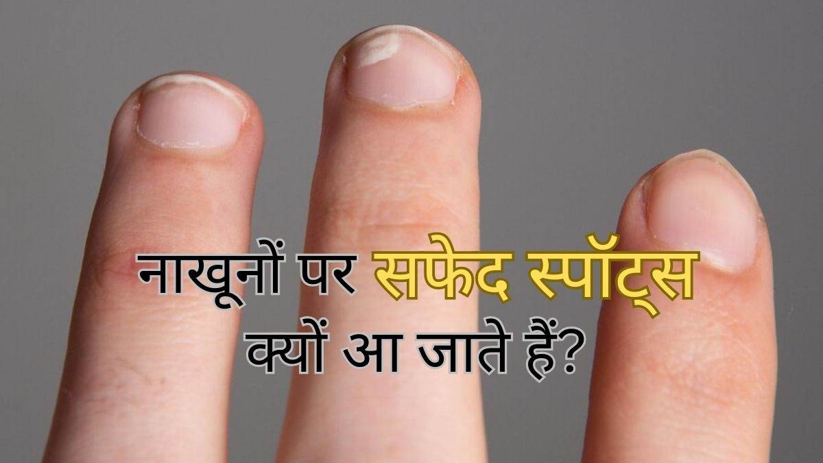 Yellow Nail Syndrome: पीले नाखून देते हैं शरीर में हो रही कुछ बीमारियों का  संकेत, भूलकर भी न करें अनदेखा - what is yellow nail syndrome its causes and  how it affects