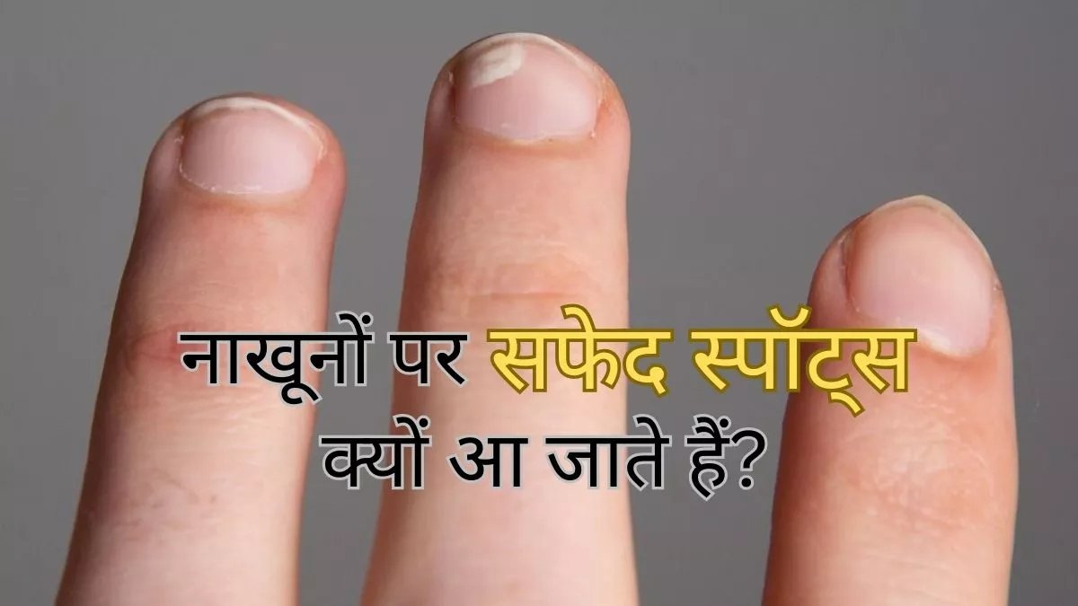 नाखून संक्रमण, पैरोनीचिया, Paronychia- Nail Infection | Acupressure  therapy, Acupressure, Reflexology treatment