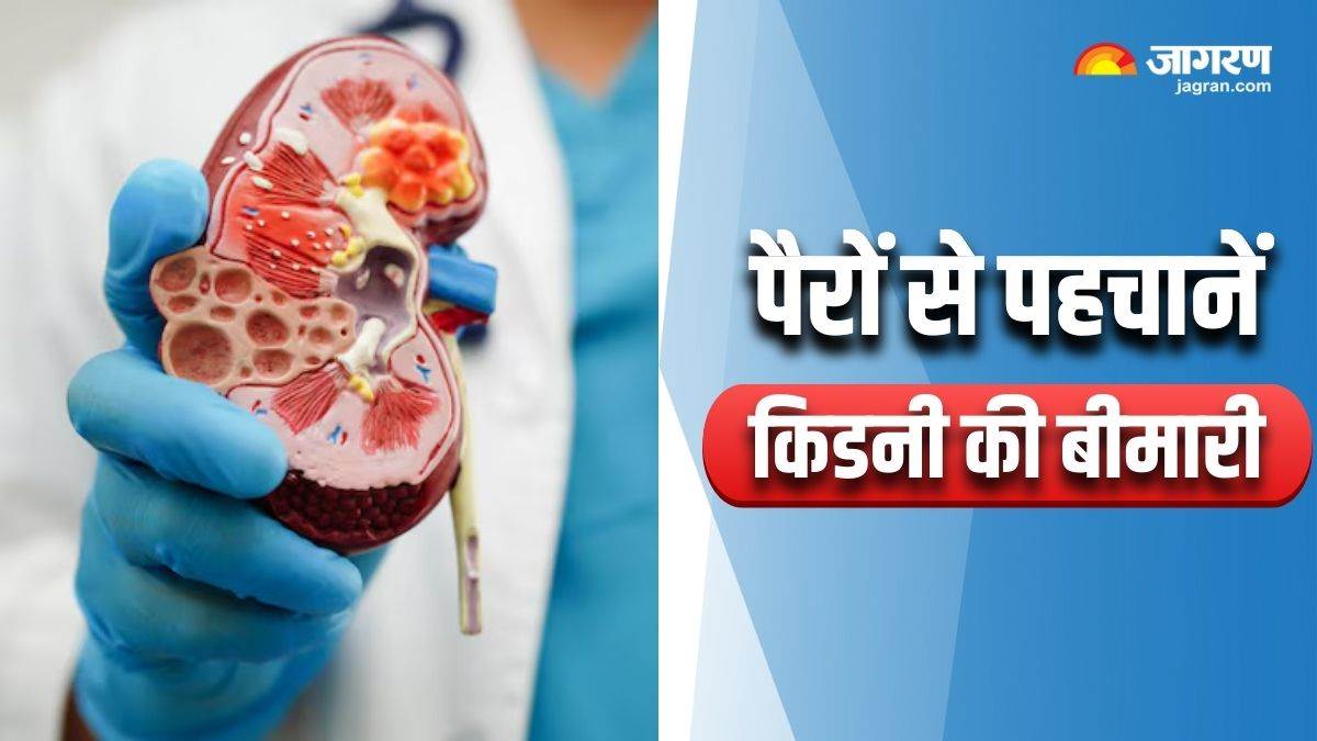 https://www.jagranimages.com/images/newimg/06092025/06_09_2025-kidney_damage_symptoms_24037533.jpg