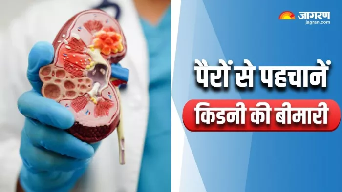 पैरों में दिखने वाले 5 लक्षण बताते हैं खराब हो रही है किडनी (Image Source: Freepik)