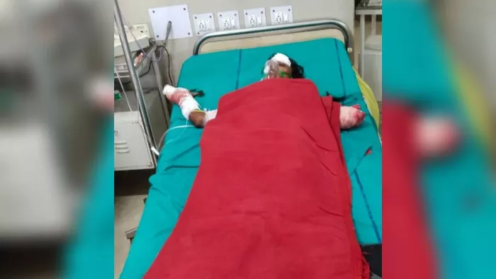 हादसे में घायल हुई महिला रीना देवी उर्फ गुड्डी।