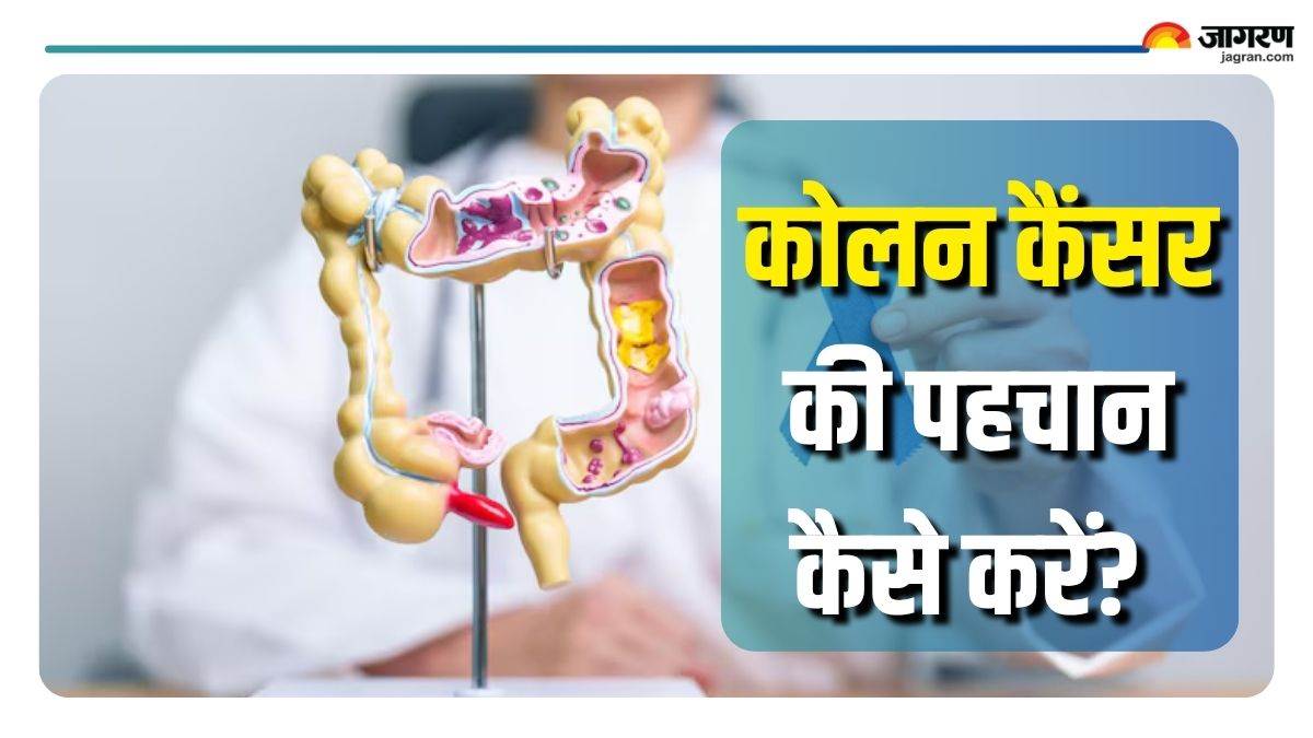 5 warning signs of colon cancer which can help in early detection check details here