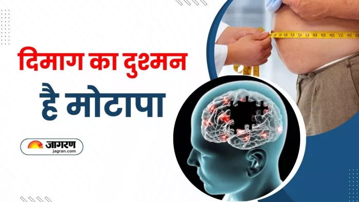अल्जाइमर रोग का कारण बन सकता है मोटापा: स्टडी (Image Source: Freepik)