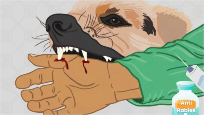 Anti Rabies Injection: कुत्ते के काटने पर अब 5 नहीं इतने इंजेक्शन ...