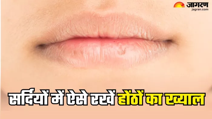 सर्दियों में ऐसे रखें होंठों का ख्याल (Picture Credit- Freepik)