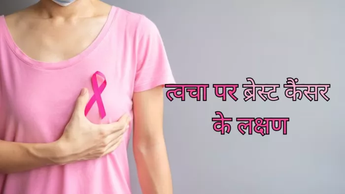 ब्रेस्ट कैंसर के त्वचा पर नजर आते हैं ये संकेत