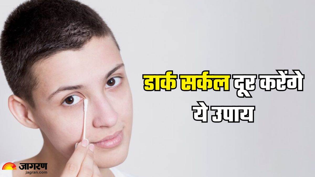 https://www.jagranimages.com/images/newimg/07022025/07_02_2025-dark_circles_2_23880181.jpg