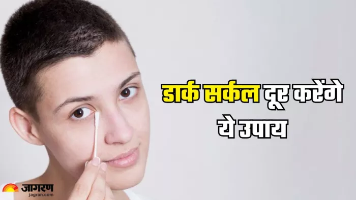 डार्क सर्कल से पाएं मिनटों में छुटकारा (Picture Credit- Freepik)