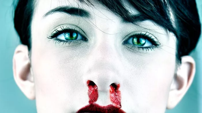 Nosebleeding: क्या है नाक से खून आने का कारण, कैसे करें बचाव? जानें