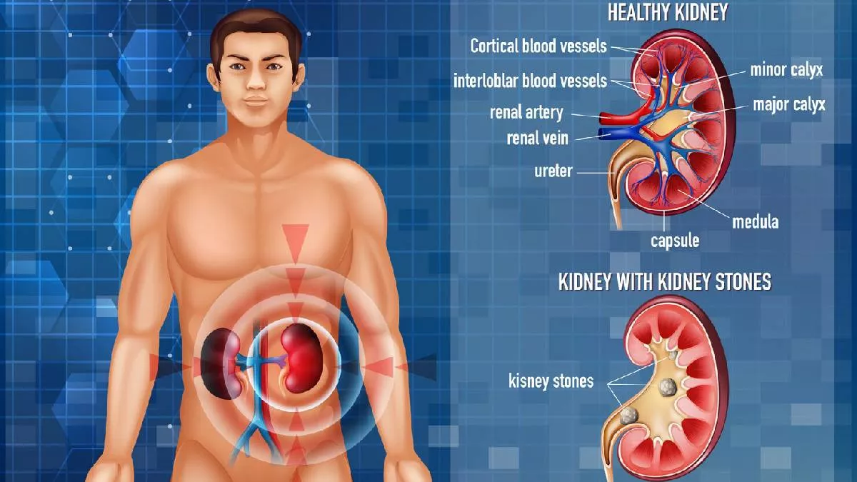 World Kidney Day 2023: सेहत को बुरी तरह से प्रभावित कर सकती हैं किडनी की ये  3 समस्याएं, जान लें इनके लक्षण - World kidney Day 2023 These 3 kidney  problems can