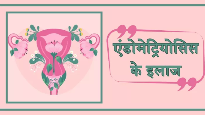 एक्सपर्ट ने बताए एंडोमेट्रियोसिस के इलाज के विकल्प