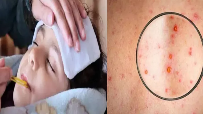 Summer Diseases: तापमान बढ़ने के साथ सताएंगी बीमारियां, बचाव ही पहला इलाज। फाइल फोटो
