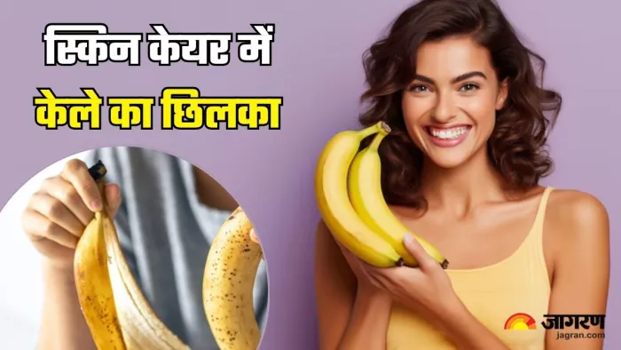 क्या Skincare में फायदा पहुंचाएगा केले का छिलका? (Image Source: Freepik)