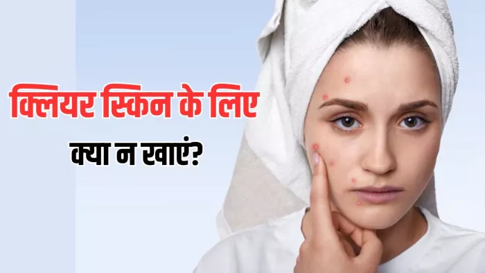 Foods to Avoid for Clear Skin: इन सफेद फूड्स को कर दें डाइट से बाहर! (Picture Courtesy: Freepik)