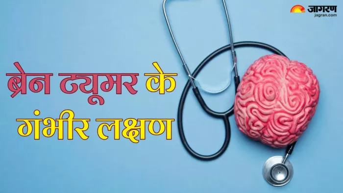 हल्के में न लें ब्रेन ट्यूमर के ये लक्षण (Picture Credit- Freepik)