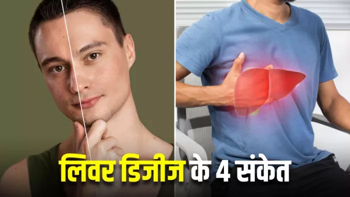Liver Disease की ओर इशारा करते हैं त्वचा में नजर आने वाले 4 बदलाव (Image Source: Freepik)