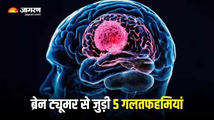 World Brain Tumor Day 2025: ब्रेन ट्यूमर से जुड़े 5 सबसे आम मिथक (Image Source: Freepik)