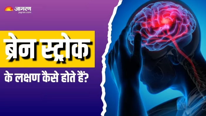 ब्रेन स्ट्रोक आने पर दिखाई देते हैं ये लक्षण (Picture Courtesy: Freepik)