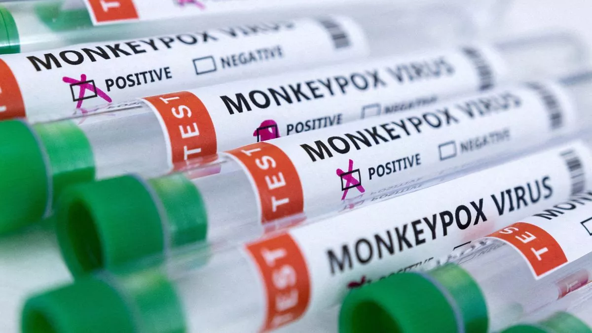Monkeypox Vaccination: फ्रांस की यूनिवर्सिटी का दावा- Ring Vaccination से नहीं थमेगी बीमारी; जानिए क्या है ये रणनीति