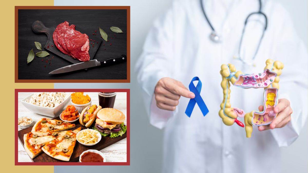 https://www.jagranimages.com/images/newimg/07082025/07_08_2025-colon_cancer_1_24006048.jpg