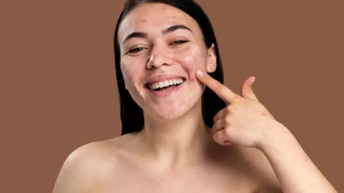 Skin Care Tips: चेहरे के दाग-धब्बों से हैं परेशान, तो अपनाएं ये घरेलू उपाय