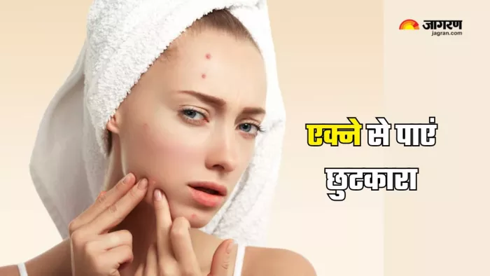 एक्ने को कम करने के लिए खान-पान में करें ये सुधार (Picture Courtesy: Freepik)
