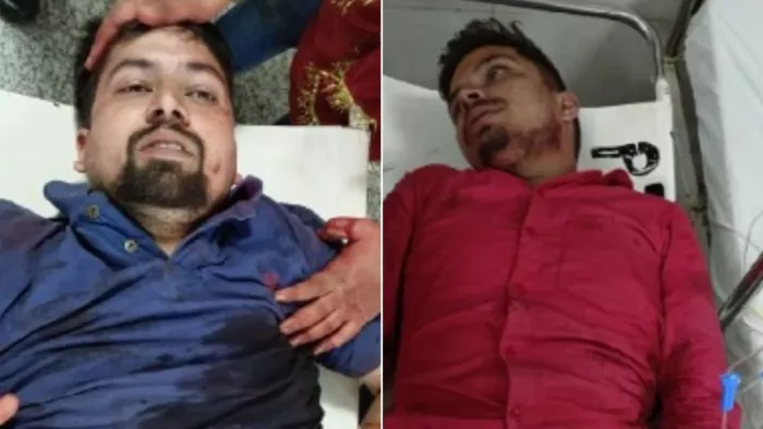 गोरखपुर में दबंगों के हौसले बुलंद, मूर्ति विसर्जन में शामिल दवा व्यवसायी को मारी गोली- युवक को घोंपा चाकू