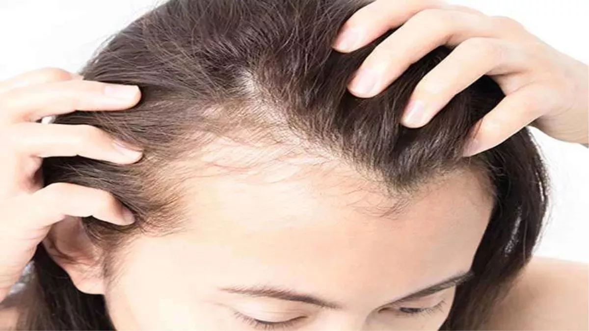Hair fall problem for men stock photo Image of examining  219209526