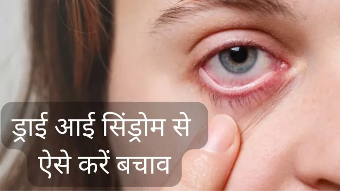 ड्राई आई से बचने के लिए अपनाएं ये टिप्स