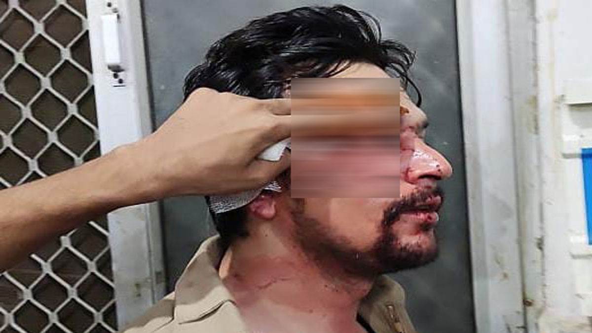 Haridwar News : बदमाशों ने लोहे की रॉड से चालक के सिर पर वार कर उसे लहूलुहान कर दिया।