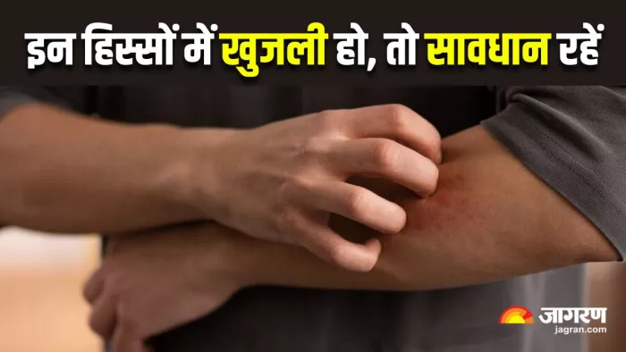 गलती से भी नजरअंदाज न करें शरीर के इन 5 हिस्सों की खुजली (Image Source: Freepik)