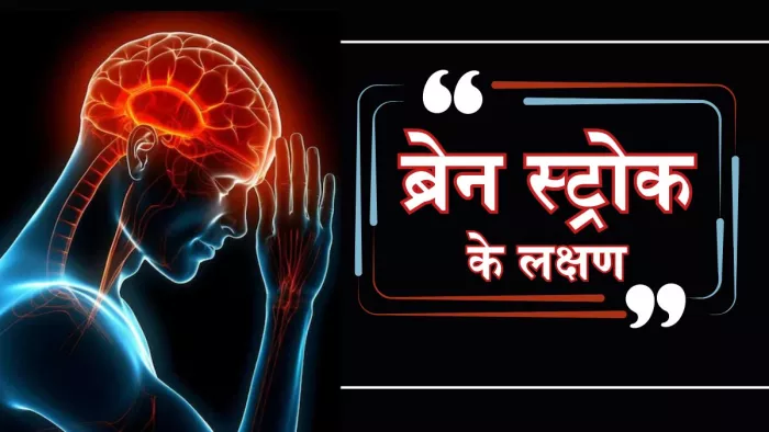 इन तरीकों से करें स्ट्रोक से बचाव