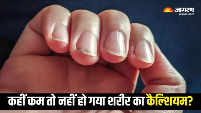 Calcium Deficiency: नाखून भी करते हैं कैल्शियम की कमी का इशारा (Picture Courtesy: Freepik)