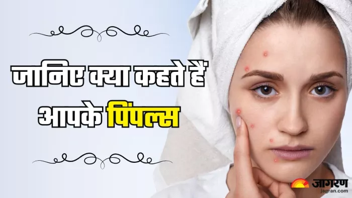 पिंपल खोलेंगे सेहत का राज (Picture Credit- Freepik)