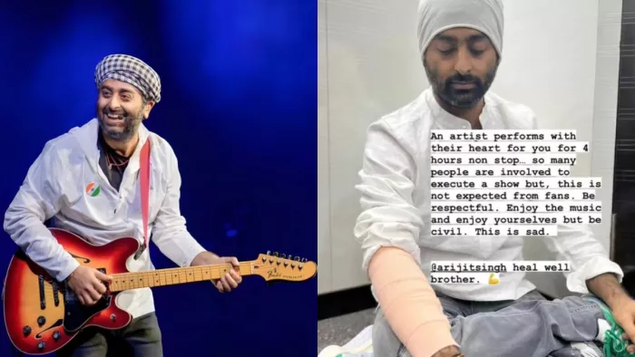 Arijit singh, arijit singh injured,. Photo Credit Instagram