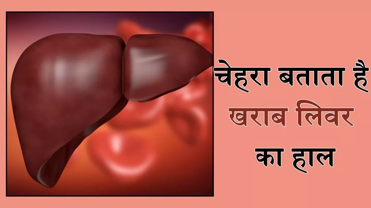 Liver Damage का संकेत देता है आपका चेहरा, इन लक्षणों से करें इसकी पहचान