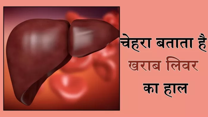 लिवर डैमेज के चेहरे पर नजर आते हैं ये संकेत (Picture Courtesy: Freepik)