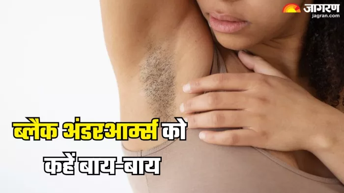 इन तरीकों से पाएं अंडरआर्म्स के कालेपन से छुटकारा (Picture Credit- Freepik)