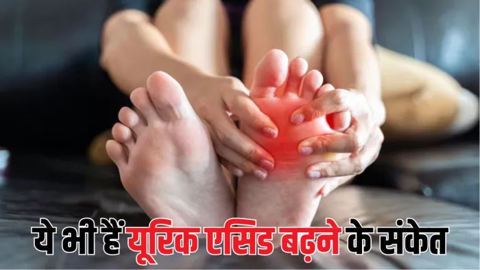 High Uric Acid के इन लक्षणों को अनदेखा करना पड़ जाएगा भारी (Picture Courtesy: Freepik)
