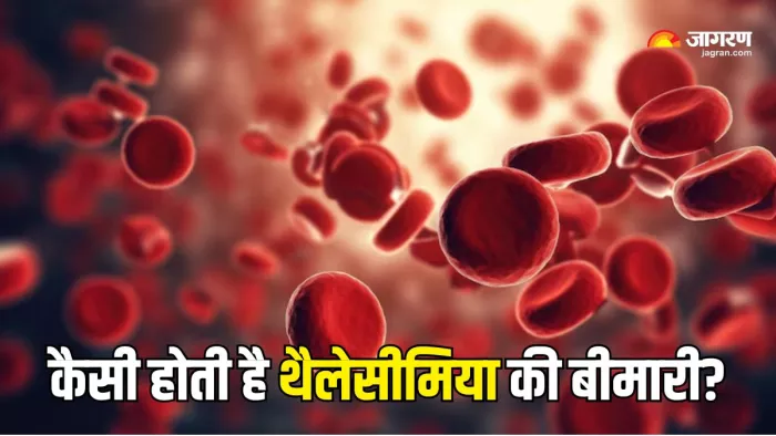 थैलेसीमिया के कितने प्रकार होते हैं? (Picture Courtesy: Freepik)