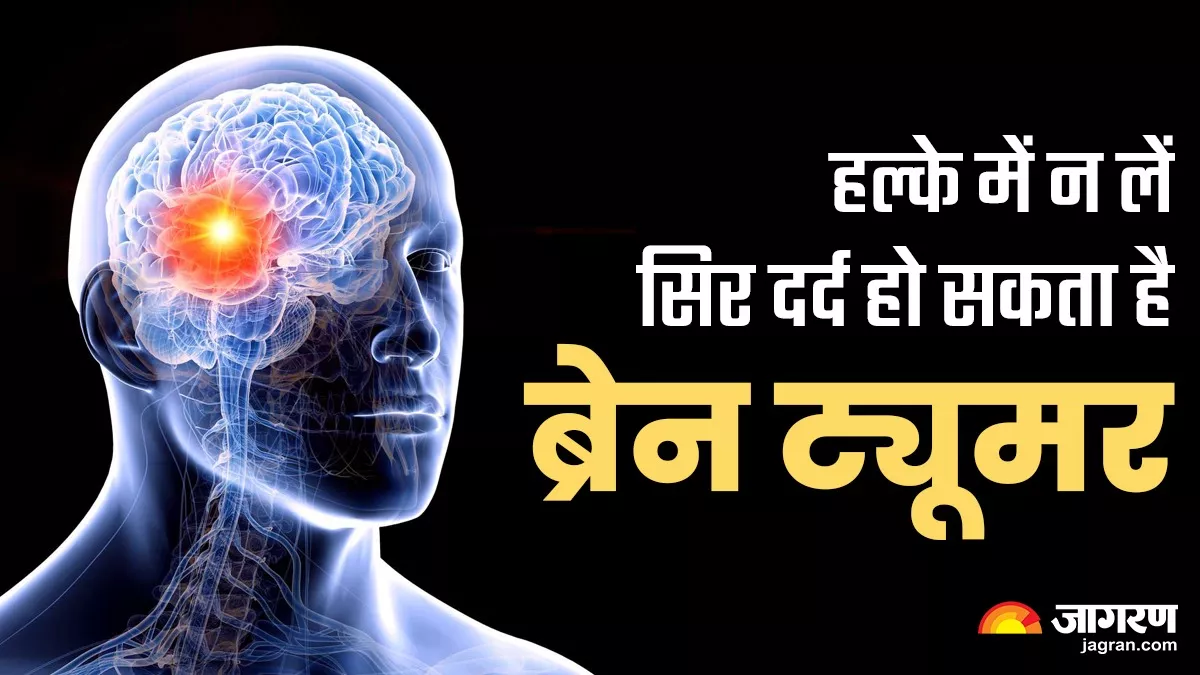 World Brain Tumor day: सिर दर्द को न करें नजरअंदाज, हो सकता है ब्रेन ट्यूमर का लक्षण, हर साल कई गवां रहे जान