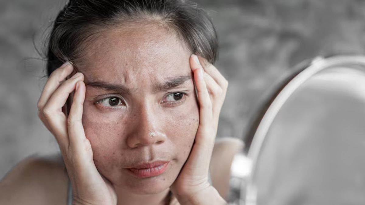 https://www.jagranimages.com/images/newimg/08062025/08_06_2025-dull_skin_issues_23959058.jpg